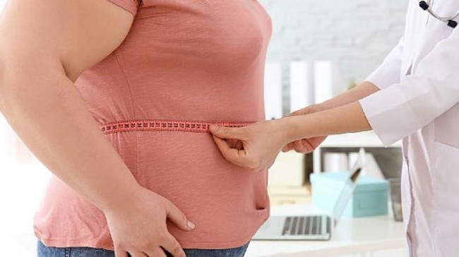 Obezite Cerrahisi Hakkında Doğru Bilinen 9 Yanlış