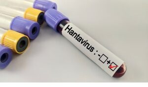 hantavirus-bir-salgina-donusur-mu.jpg